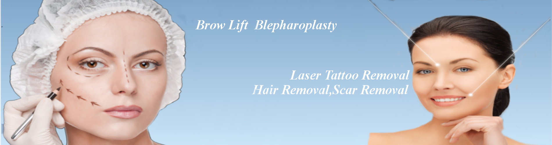 Brow lift laser tatto removal hair removal scar removal